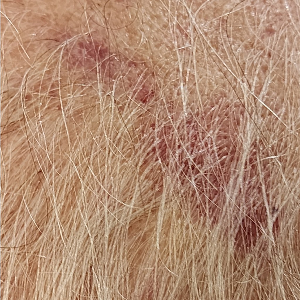 September – 2nd&nbsp;Week